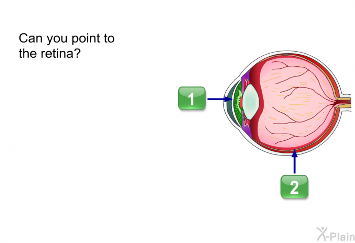 Can you point to the retina?
