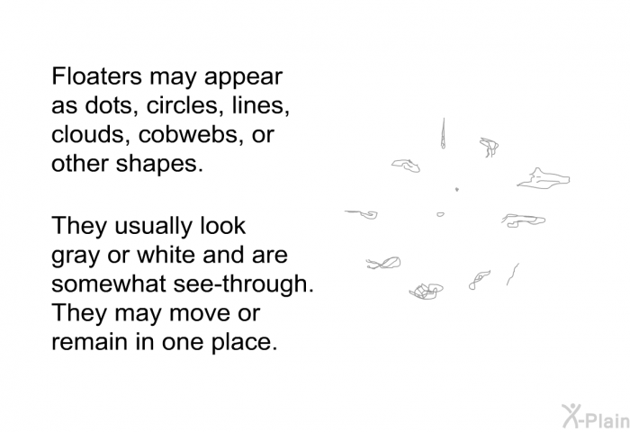 Floaters may appear as dots, circles, lines, clouds, cobwebs, or other shapes. They usually look gray or white and are somewhat see-through. They may move or remain in one place.