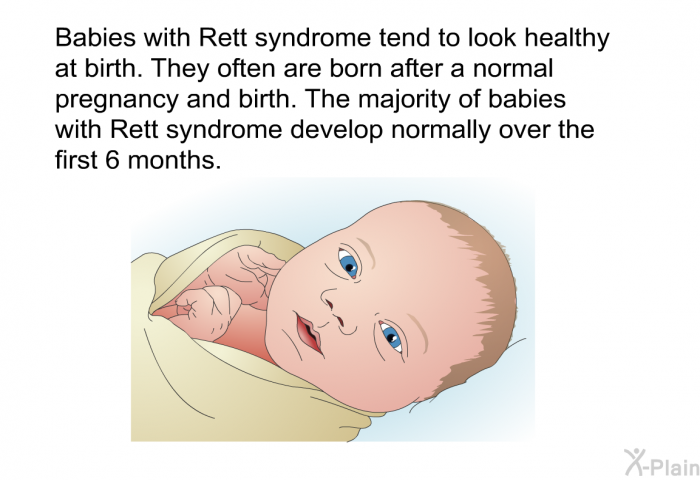 Babies with Rett syndrome tend to look healthy at birth. They often are born after a normal pregnancy and birth. The majority of babies with Rett syndrome develop normally over the first 6 months.