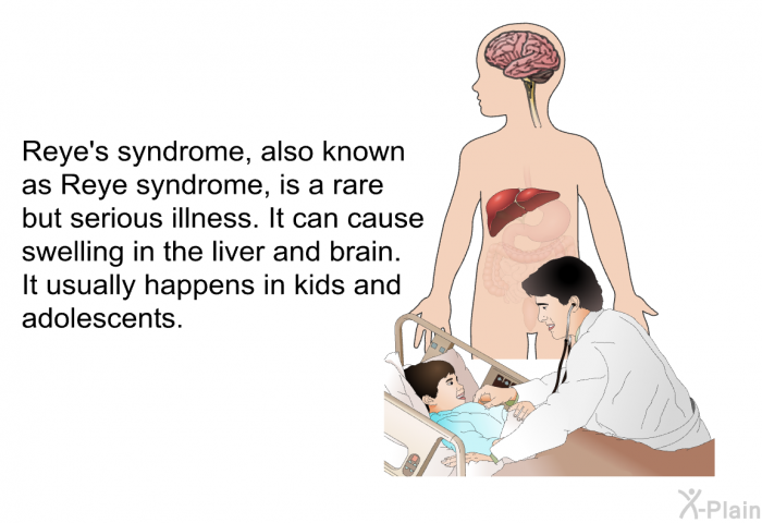 Reye's syndrome, also known as Reye syndrome, is a rare but serious illness. It can cause swelling in the liver and brain. It usually happens in kids and adolescents.