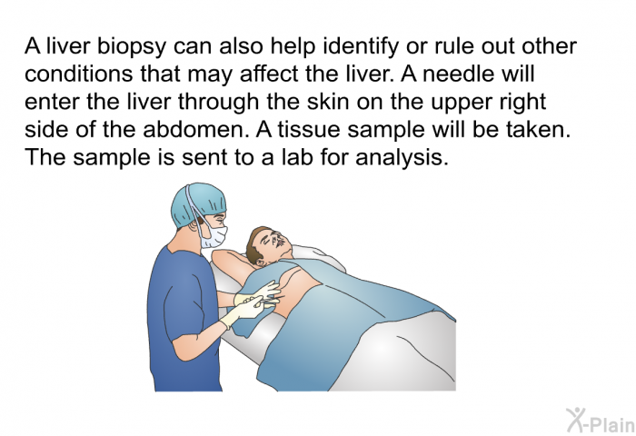 A liver biopsy can also help identify or rule out other conditions that may affect the liver. A needle will enter the liver through the skin on the upper right side of the abdomen. A tissue sample will be taken. The sample is sent to a lab for analysis.