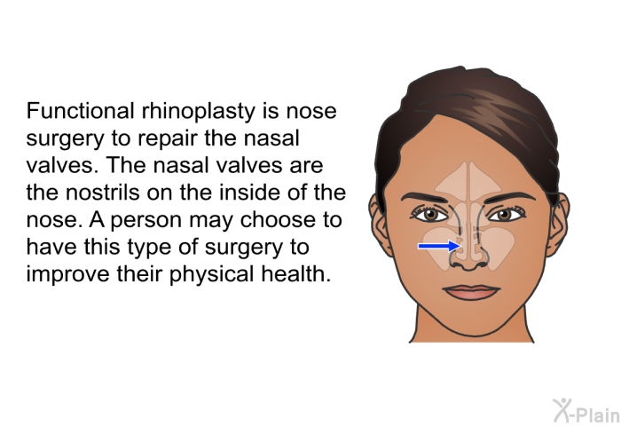 Functional rhinoplasty is nose surgery to repair the nasal valves. The nasal valves are the nostrils on the inside of the nose. A person may choose to have this type of surgery to improve their physical health.
