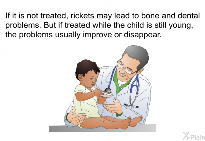 If it is not treated, rickets may lead to bone and dental problems. But if treated while the child is still young, the problems usually improve or disappear.