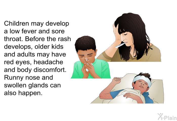 Children may develop a low fever and sore throat. Before the rash develops, older kids and adults may have red eyes, headache and body discomfort. Runny nose and swollen glands can also happen.