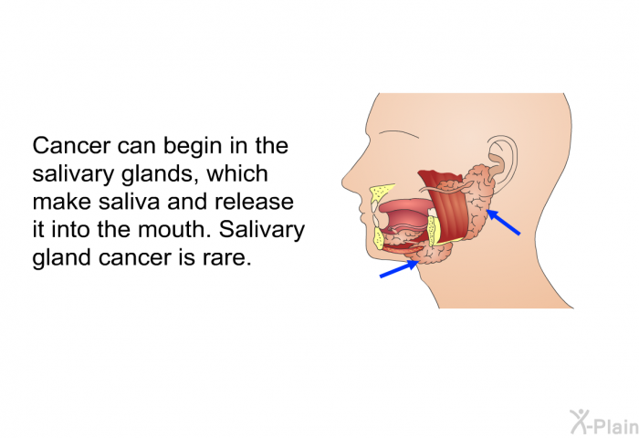 Cancer can begin in the salivary glands, which make saliva and release it into the mouth. Salivary gland cancer is rare.