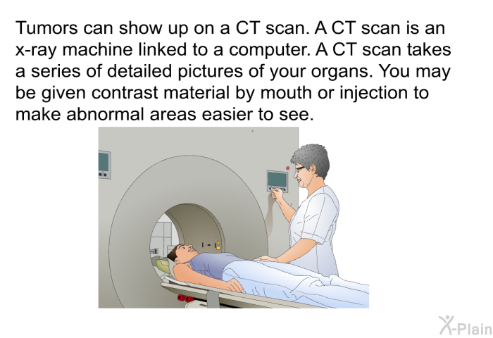 Tumors can show up on a CT scan. A CT scan is an x-ray machine linked to a computer. A CT scan takes a series of detailed pictures of your organs. You may be given contrast material by mouth or injection to make abnormal areas easier to see.