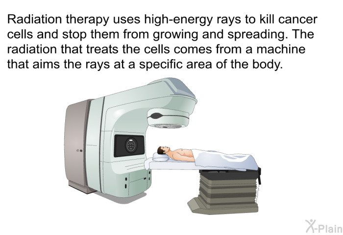 Radiation therapy uses high-energy rays to kill cancer cells and stop them from growing and spreading. The radiation that treats the cells comes from a machine that aims the rays at a specific area of the body.