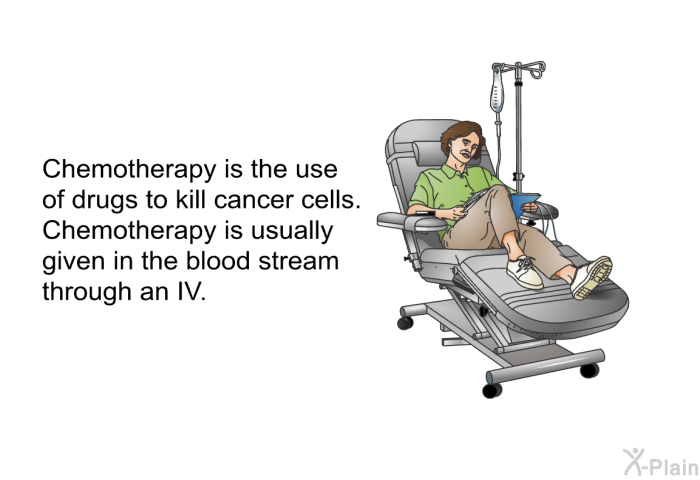 Chemotherapy is the use of drugs to kill cancer cells. Chemotherapy is usually given in the blood stream through an IV.