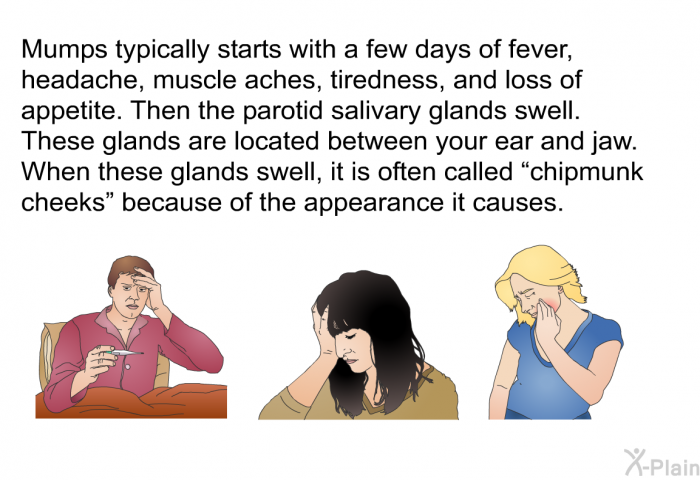 Mumps typically starts with a few days of fever, headache, muscle aches, tiredness, and loss of appetite. Then the parotid salivary glands swell. These glands are located between your ear and jaw. When these glands swell, it is often called &ldquo;chipmunk cheeks&rdquo; because of the appearance it causes.