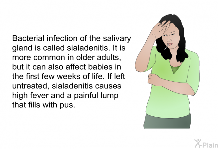 Bacterial infection of the salivary gland is called sialadenitis. It is more common in older adults, but it can also affect babies in the first few weeks of life. If left untreated, sialadenitis causes high fever and a painful lump that fills with pus.