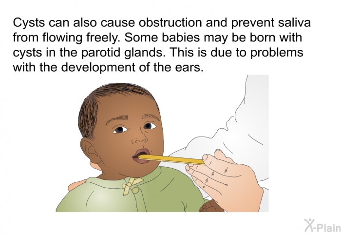 Cysts can also cause obstruction and prevent saliva from flowing freely. Some babies may be born with cysts in the parotid glands. This is due to problems with the development of the ears.
