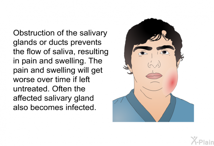 Obstruction of the salivary glands or ducts prevents the flow of saliva, resulting in pain and swelling. The pain and swelling will get worse over time if left untreated. Often the affected salivary gland also becomes infected.