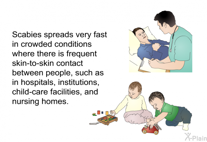 Scabies spreads very fast in crowded conditions where there is frequent skin-to-skin contact between people, such as in hospitals, institutions, child-care facilities, and nursing homes.