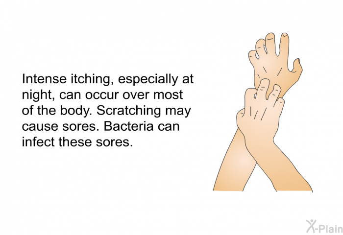 Intense itching, especially at night, can occur over most of the body. Scratching may cause sores. Bacteria can infect these sores.