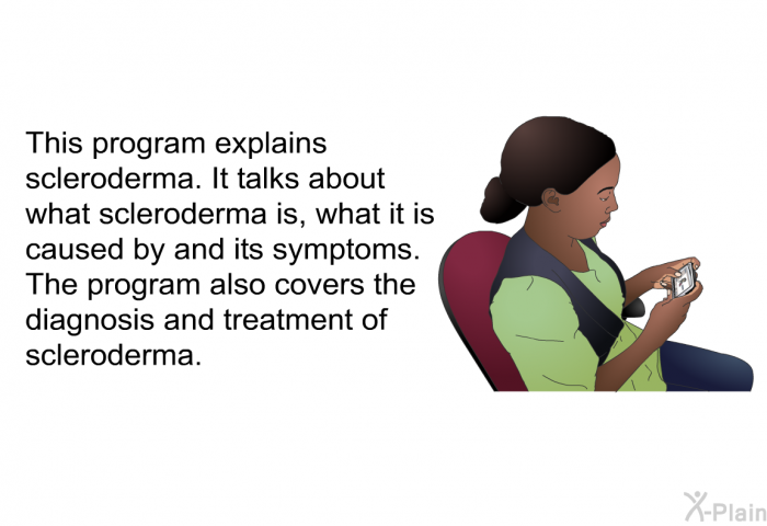 This health information explains scleroderma. It talks about what scleroderma is, what it is caused by and its symptoms. It also covers the diagnosis and treatment of scleroderma.