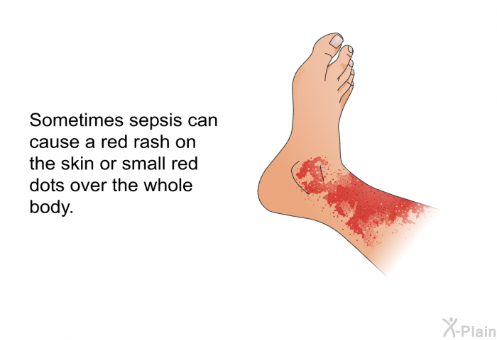 Sometimes sepsis can cause a red rash on the skin or small red dots over the whole body.