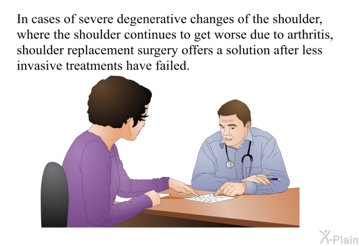 In cases of severe degenerative changes of the shoulder, where the shoulder continues to get worse, your doctor may consider shoulder replacement.