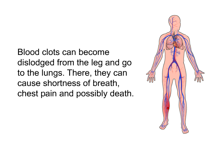 Blood clots can become dislodged from the leg and go to the lungs. There, they can cause shortness of breath, chest pain and possibly death.