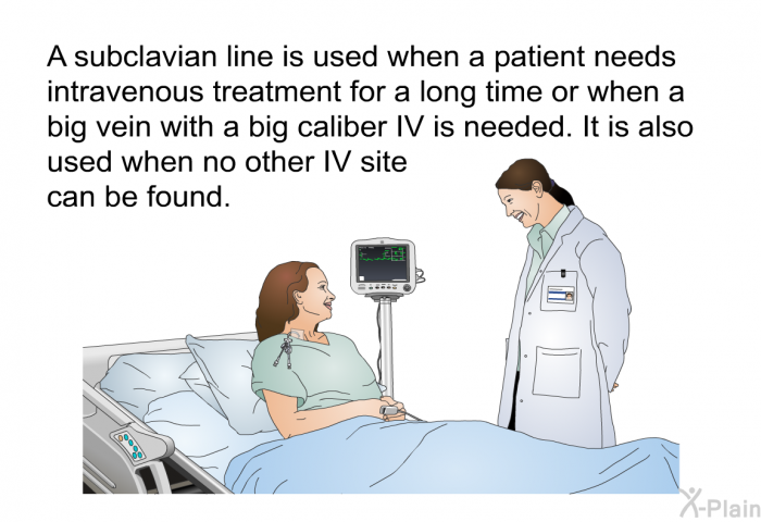 A subclavian line is used when a patient needs intravenous treatment for a long time or when a big vein with a big caliber IV is needed. It is also used when no other IV site can be found.