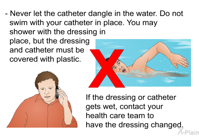 Never let the catheter dangle in the water. Do not swim with your catheter in place. You may shower with the dressing in place, but the dressing and catheter must be covered with plastic. If the dressing or catheter gets wet, contact your health care team to have the dressing changed.