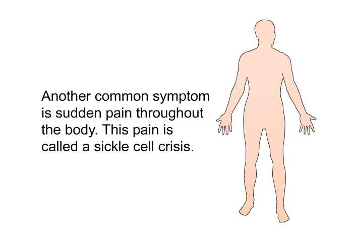 Another common symptom is sudden pain throughout the body. This pain is called a sickle cell crisis.
