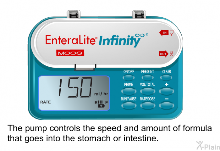 The pump controls the speed and amount of formula that goes into the stomach or intestine.