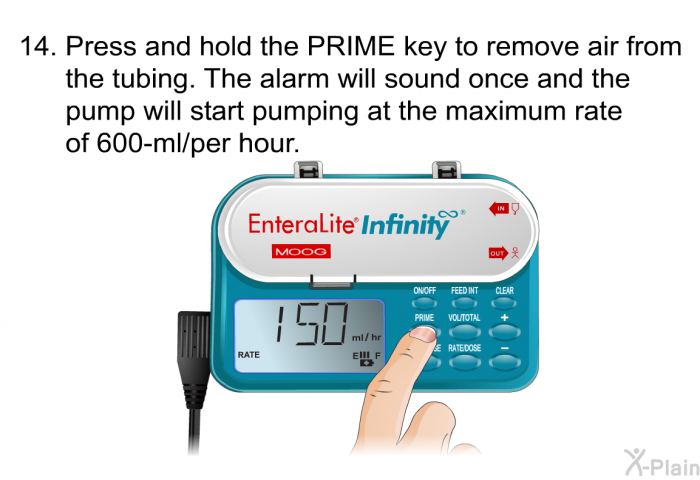 <OL START=14> Press and hold the PRIME key to remove air from the tubing. The alarm will sound once and the pump will start pumping at the maximum rate of 600-ml/per hour.