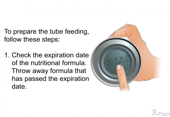 To prepare the tube feeding, follow these steps:  Check the expiration date of the nutritional formula. Throw away formula that has passed the expiration date.