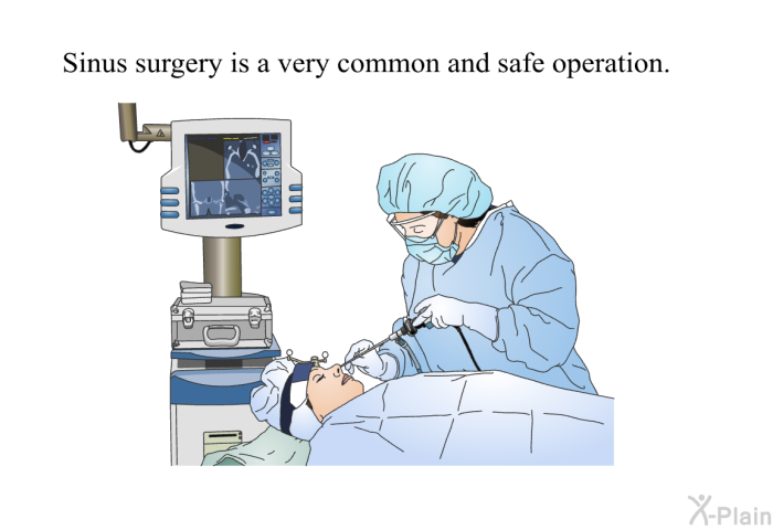 Sinus surgery is a very common and safe operation.