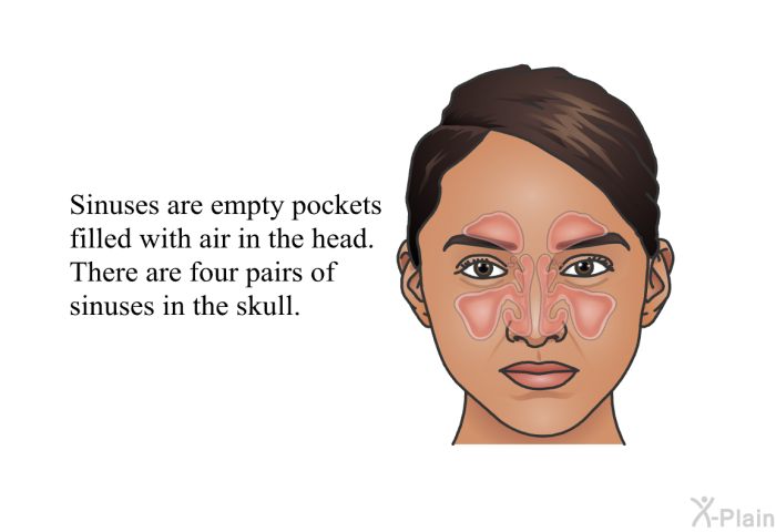 Sinuses are empty pockets filled with air in the head. There are four pairs of sinuses in the skull.