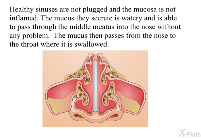 Healthy sinuses are not plugged and the mucosa is not inflamed. The mucus they secrete is watery and is able to pass through the middle meatus into the nose without any problem. The mucus then passes from the nose to the throat where it is swallowed.