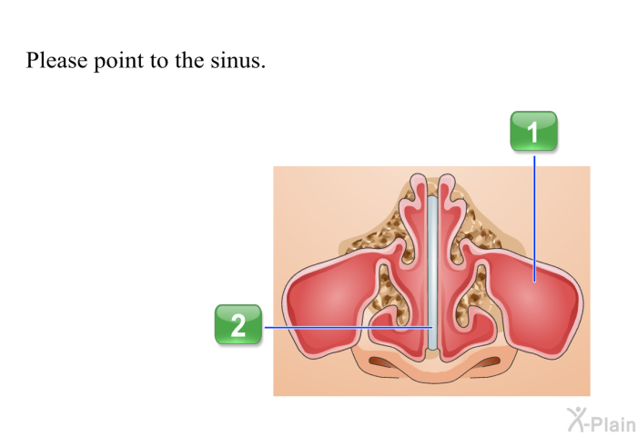 Please point to the sinus.