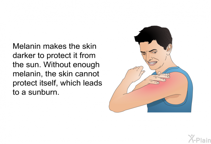 Melanin makes the skin darker to protect it from the sun. Without enough melanin, the skin cannot protect itself, which leads to a sunburn.