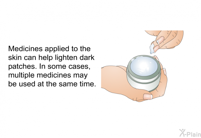 Medicines applied to the skin can help lighten dark patches. In some cases, multiple medicines may be used at the same time.