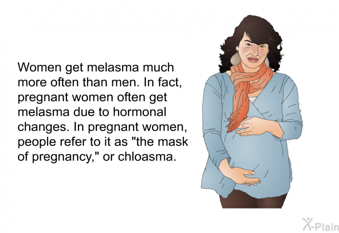 Women get melasma much more often than men. In fact, pregnant women often get melasma due to hormonal changes. In pregnant women, people refer to it as &ldquo;the mask of pregnancy,&rdquo; or chloasma.