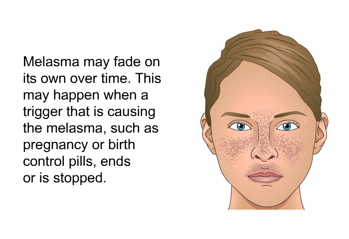 Melasma may fade on its own over time. This may happen when a trigger that is causing the melasma, such as pregnancy or birth control pills, ends or is stopped.