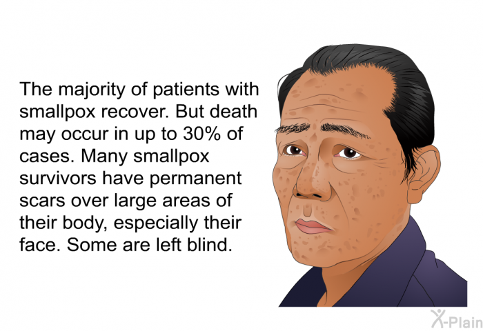 The majority of patients with smallpox recover. But death may occur in up to 30% of cases. Many smallpox survivors have permanent scars over large areas of their body, especially their face. Some are left blind.