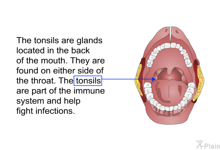 The tonsils are glands located in the back of the mouth. They are found on either side of the throat. The tonsils are part of the immune system and help fight infections.