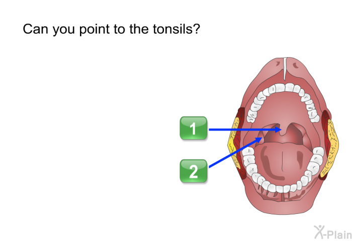 Can you point to the tonsils?