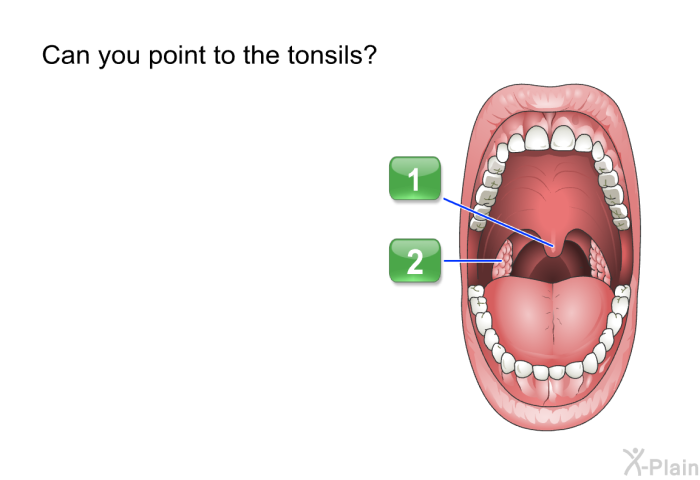 Can you point to the tonsils?