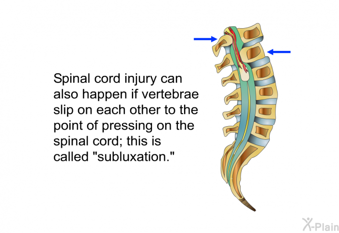 Spinal cord injury can also happen if vertebrae slip on each other to the point of pressing on the spinal cord; this is called “subluxation.”