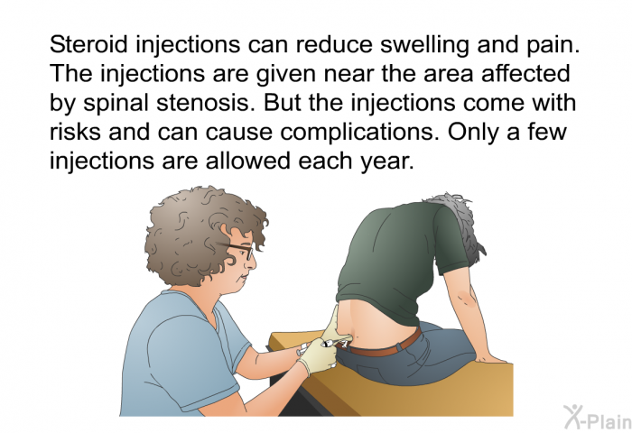 Steroid injections can reduce swelling and pain. The injections are given near the area affected by spinal stenosis. But the injections come with risks and can cause complications. Only a few injections are allowed each year.