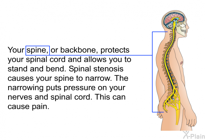 Your spine, or backbone, protects your spinal cord and allows you to stand and bend. Spinal stenosis causes your spine to narrow. The narrowing puts pressure on your nerves and spinal cord. This can cause pain.
