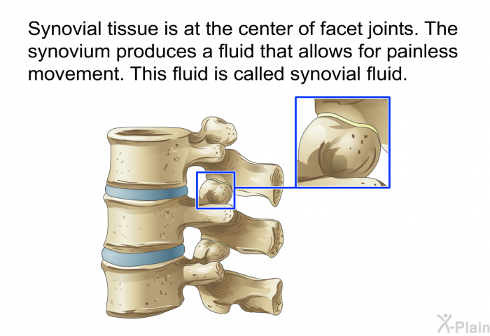 Synovial tissue is at the center of facet joints. The synovium produces a fluid that allows for painless movement. This fluid is called synovial fluid.