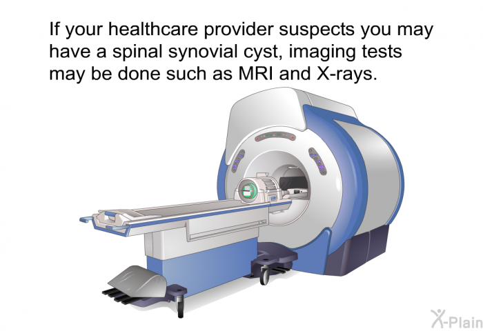 If your healthcare provider suspects you may have a spinal synovial cyst, imaging tests may be done such as MRI and X-rays.
