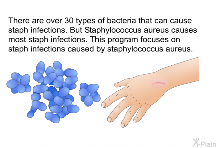 There are over 30 types of bacteria that can cause staph infections. But Staphylococcus aureus causes most staph infections. This health information focuses on staph infections caused by staphylococcus aureus.