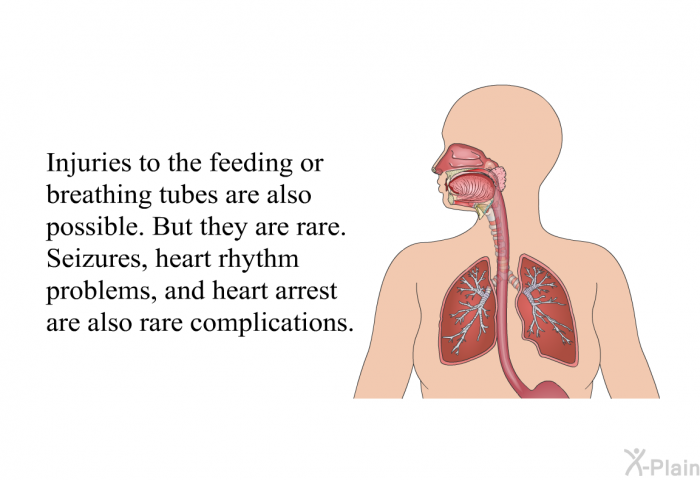 Injuries to the feeding or breathing tubes are also possible. But they are rare. Seizures, heart rhythm problems, and heart arrest are also rare complications.