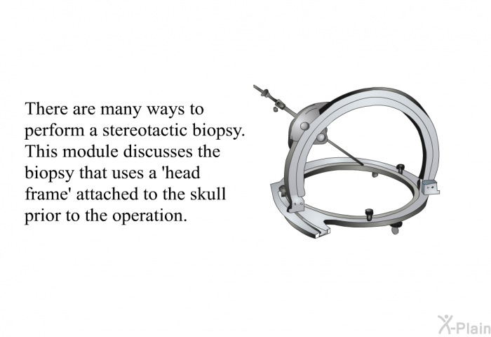 There are many ways to perform a stereotactic biopsy. This module discusses the biopsy that uses a  head frame' attached to the skull prior to the operation.