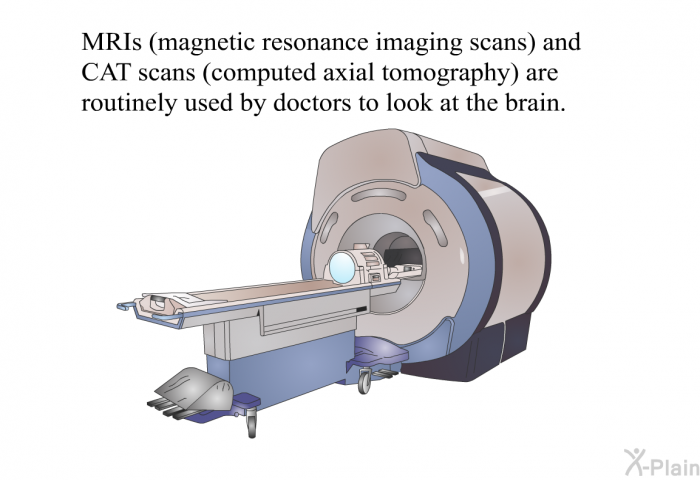 MRIs (magnetic resonance imaging scans) and CAT scans (computed axial tomography) are routinely used by doctors to look at the brain.