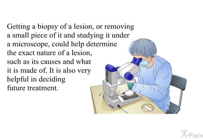 Getting a biopsy of a lesion, or removing a small piece of it and studying it under a microscope, could help determine the exact nature of a lesion, such as its causes and what it is made of. It is also very helpful in deciding future treatment.